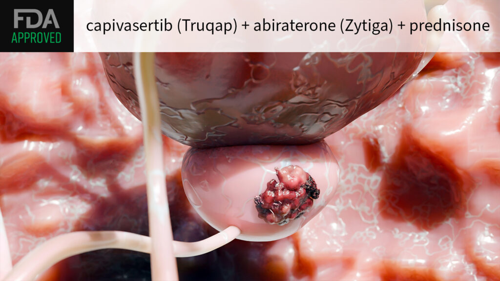 FDA Approves Prostate Cancer Combo That Warranted Advisory Meeting