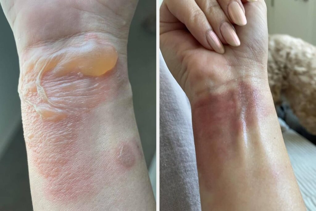 37 Products With Results That Prove There May Be A Solution For Issues That Once Seemed Hopeless