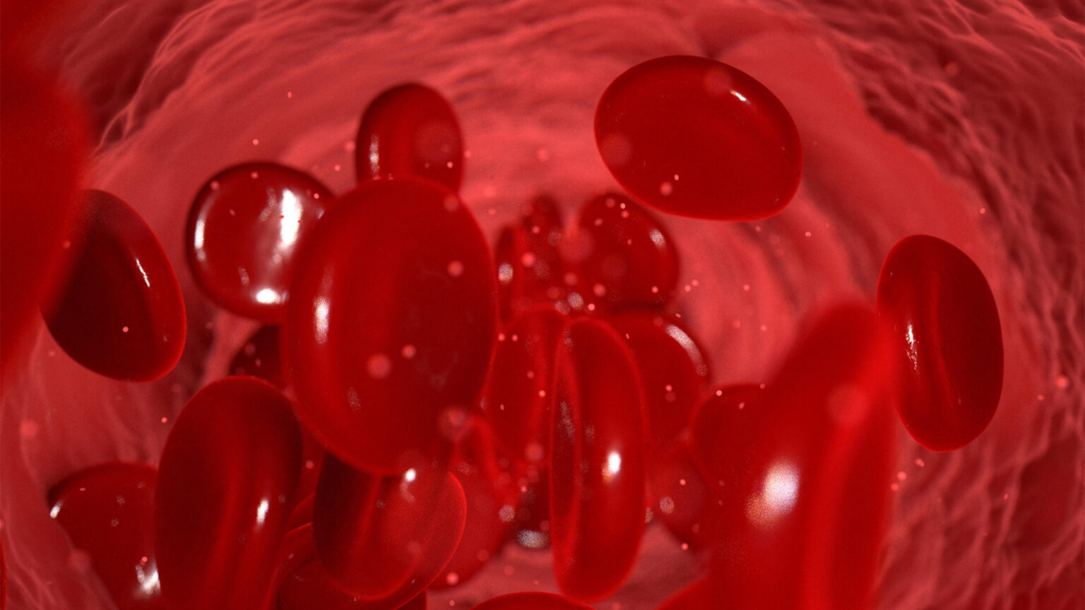 This Test Outperformed SCORE2 for Gauging Heart Risk in Rheumatic Disease