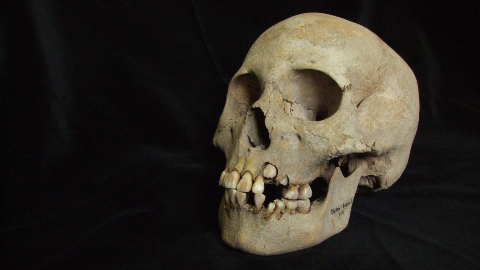 Ancient Teeth Push the Plague’s Timeline Back to Over 5,500 Years Ago