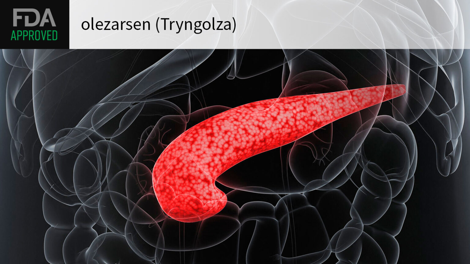 Severe Hypertriglyceridemia Drug Approved to Reduce Triglycerides, Pancreatitis Risk