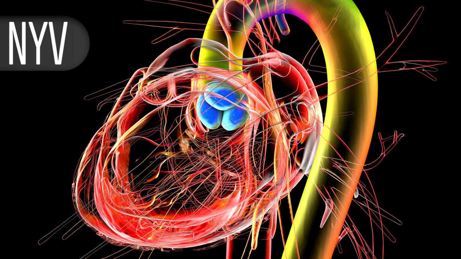 Aortic Stenosis Patients Still Tripped Up by Diagnosis Issues on the Path to AVR