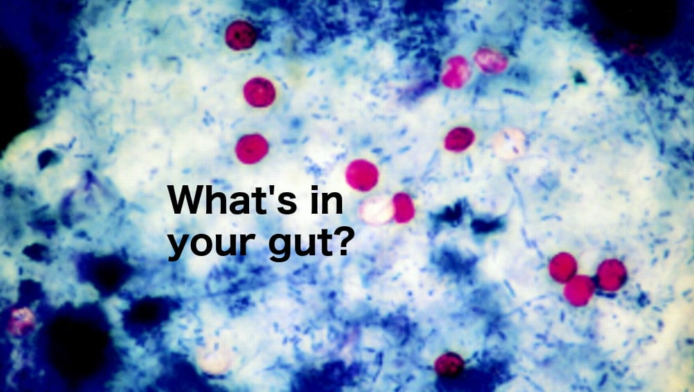 Cyclospora cases surge to nearly 600 in Michigan Cyclospora cases surge to nearly 600 in Michigan