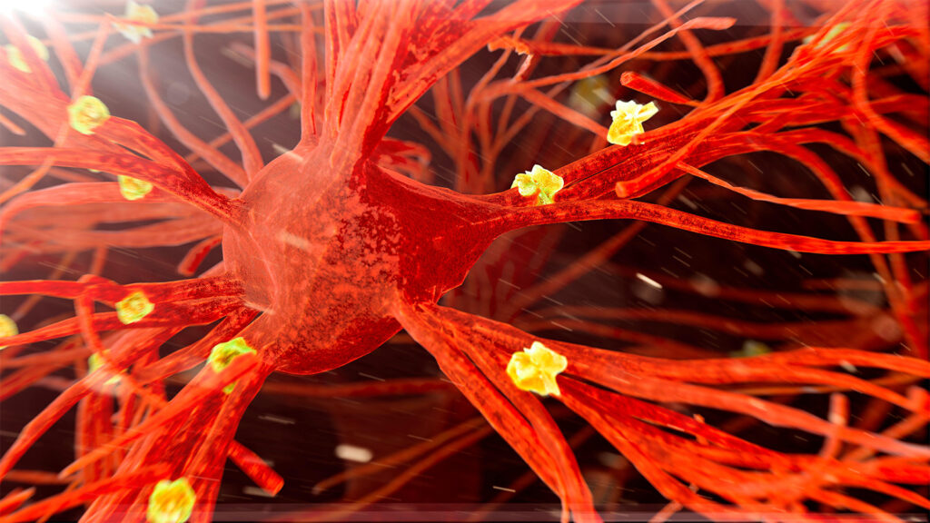 Alzheimer’s Biomarkers Change After Tuberculosis Vaccination