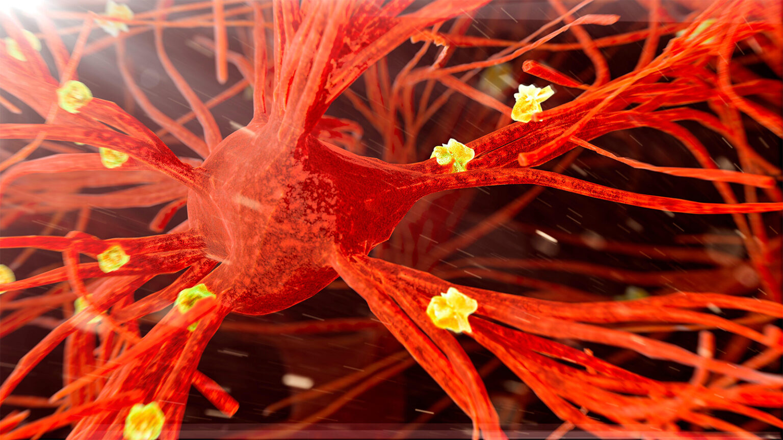 Alzheimer’s Biomarkers Change After Tuberculosis Vaccination