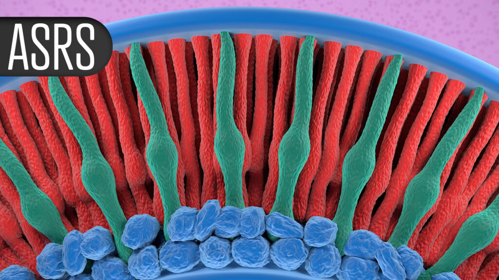Vision Benefits in GA With Complement Inhibitor, Regardless of AMD, Anti-VEGF