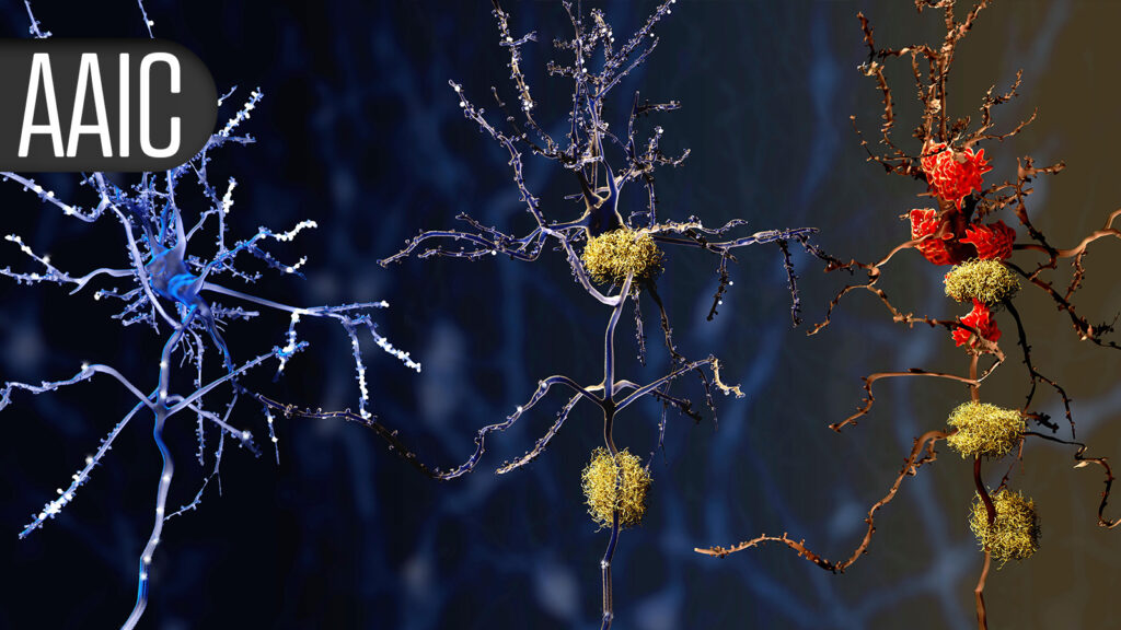 Brain Aging Advances More Quickly for People With Metabolic Syndrome