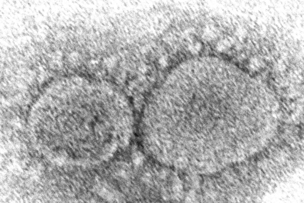 HHS adopts policy to limit virus research; ‘gain-of-function’ experiments implicated in COVID origin