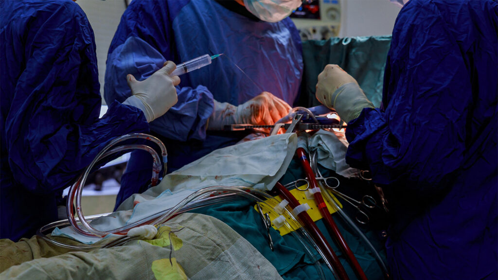 Dapagliflozin Makes Good on Preventing Cardiac Surgery-Associated AKI