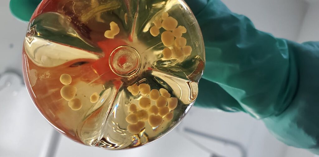 Recurring risk: Like Zika, Oropouche virus can also affect the brains of unborn babies