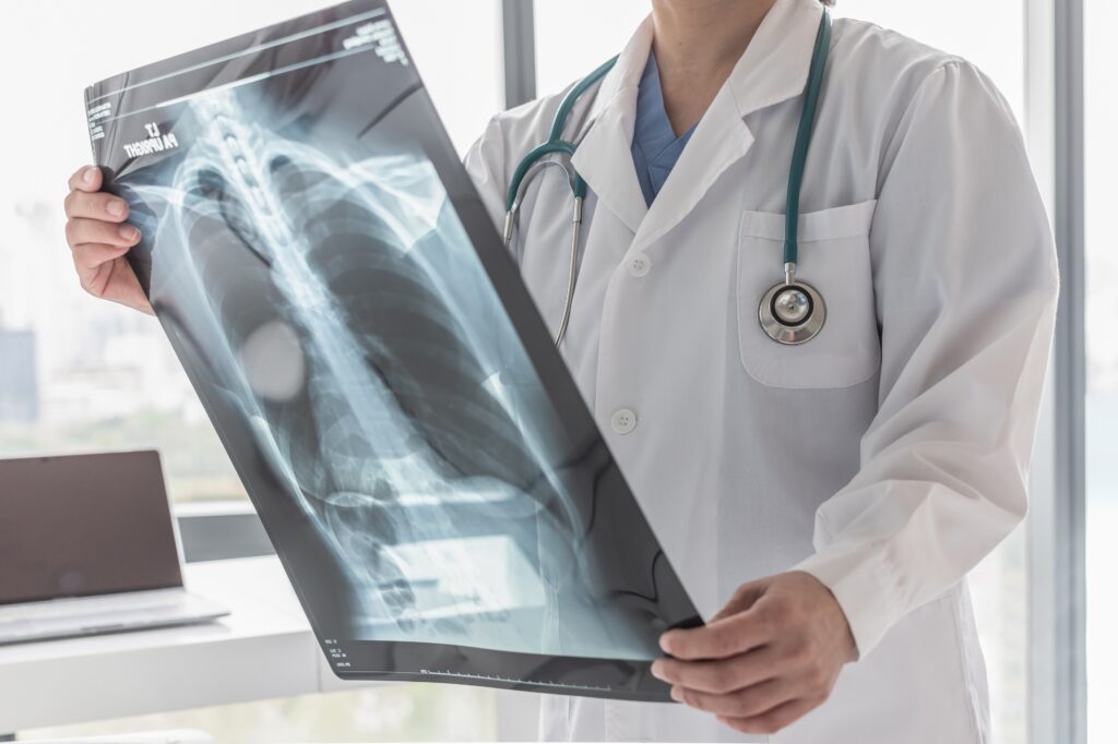 Years After He Quit Smoking, a Lung Cancer Scan Saved His Life Years After He Quit Smoking, a Lung Cancer Scan Saved His Life