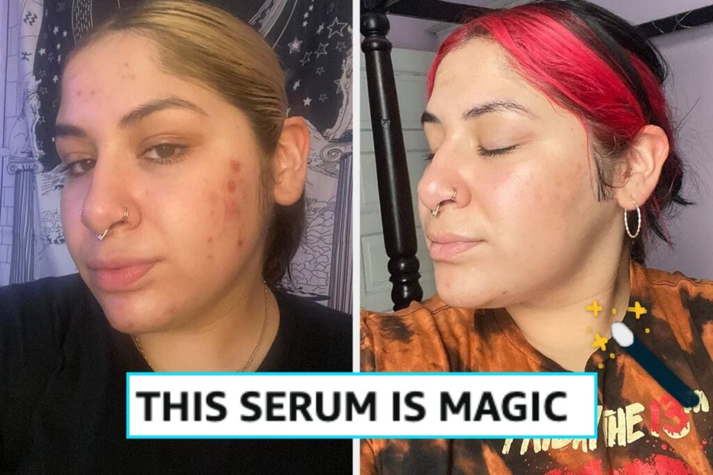 26 Skincare Products That Get A Lot Of Hype But Aren’t *Just* Hype 26 Skincare Products That Get A Lot Of Hype But Aren’t *Just* Hype