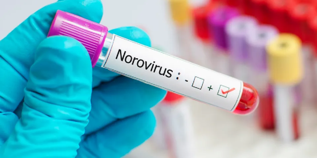 Source of Belgian norovirus outbreak remains unknown Source of Belgian norovirus outbreak remains unknown
