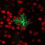 Astrocytes could help track the timing of frightening experiences