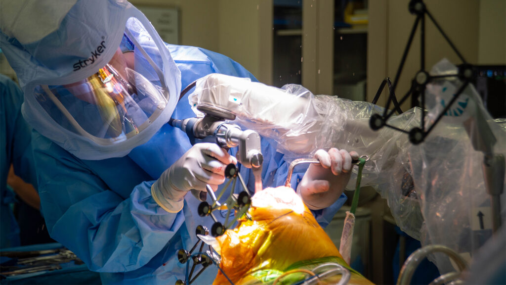 Epic Fail: Robots Don’t Improve Joint Replacement Outcomes in Big U.K. Studies