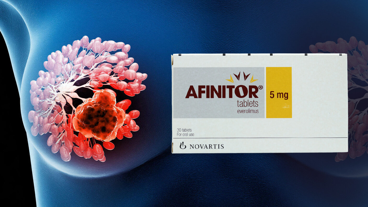 SERD Combination Slows Breast Cancer After CDK4/6 Inhibitor Progression
