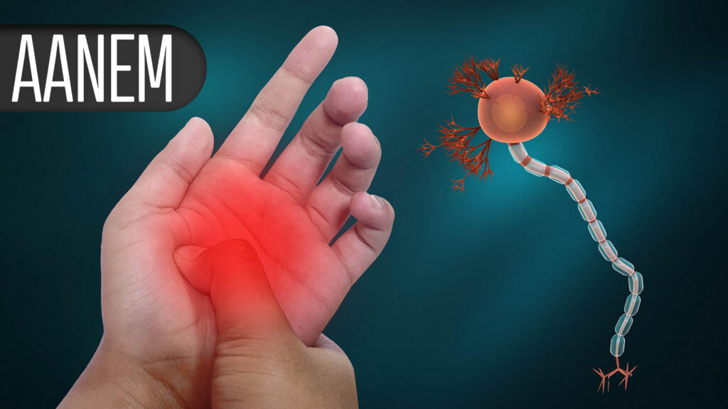 Ocular Myasthenia Gravis Scores Improve With Subcutaneous Treatment