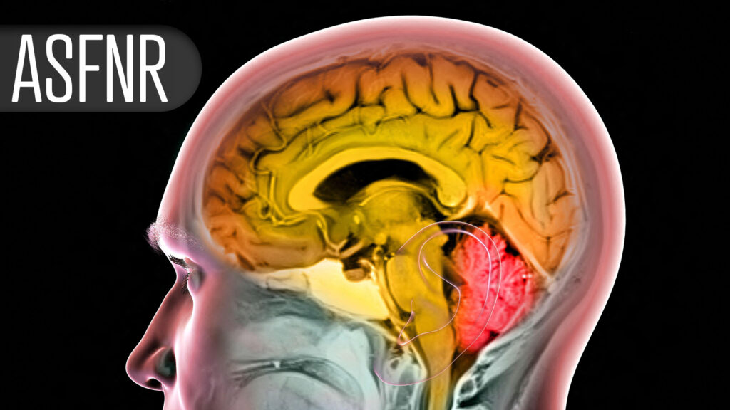 Antioxidant May Influence Brain Changes in Multiple Sclerosis, Study Suggests