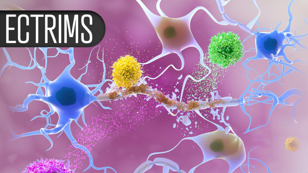 Patient Death Reported in Multiple Sclerosis CAR-T Study